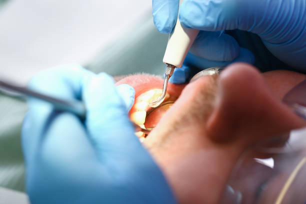 Best Knocked-Out Tooth Emergency  in West Yarmouth, MA
